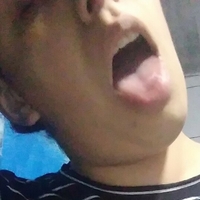 abyrodr Naakt