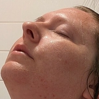 titlaser Naakt